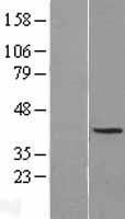 NUCKS1 Human Over-expression Lysate