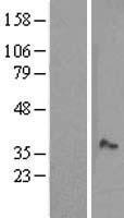 MOSC1 (MARC1) Human Over-expression Lysate