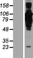 CCDC21 (CEP85) Human Over-expression Lysate