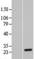 PSF3 (GINS3) Human Over-expression Lysate