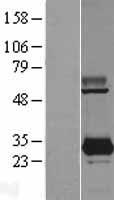 PYCR3 Human Over-expression Lysate