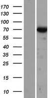 Dynein intermediate chain 2 (DNAI2) Human Over-expression Lysate
