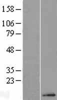 CCDC71 Human Over-expression Lysate