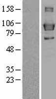 Lipin 3 (LPIN3) Human Over-expression Lysate