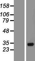 Gemin 1 (SMN2) Human Over-expression Lysate