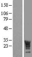 LRRC61 Human Over-expression Lysate