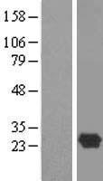 DBNDD1 Human Over-expression Lysate