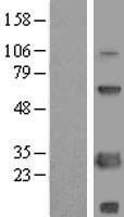 SCNM1 Human Over-expression Lysate