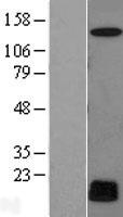 MRI (C7orf49) Human Over-expression Lysate