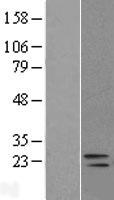 DUSP26 Human Over-expression Lysate