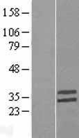 Neurogenin 2 (NEUROG2) Human Over-expression Lysate