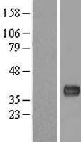 C11orf48 (LBHD1) Human Over-expression Lysate