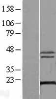 XTP3TPA (DCTPP1) Human Over-expression Lysate