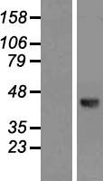 DSCC1 Human Over-expression Lysate