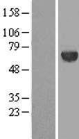 METT10D (METTL16) Human Over-expression Lysate