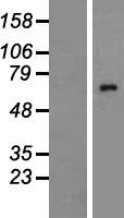 ALG8 Human Over-expression Lysate