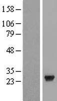 CCDC28B Human Over-expression Lysate