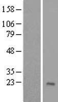 ZNF576 Human Over-expression Lysate