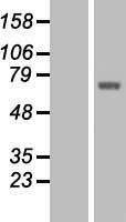 TCTN1 Human Over-expression Lysate