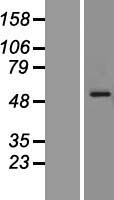 HMBOX1 Human Over-expression Lysate