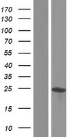 AKIRIN1 Human Over-expression Lysate
