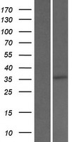 SRD5A3 Human Over-expression Lysate