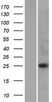 METTL21D (VCPKMT) Human Over-expression Lysate