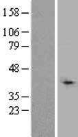 TBLR1 (TBL1XR1) Human Over-expression Lysate