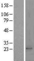 PRKRIP1 Human Over-expression Lysate