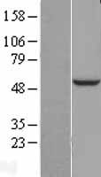 C11orf80 Human Over-expression Lysate