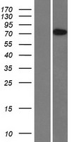 BBS10 Human Over-expression Lysate