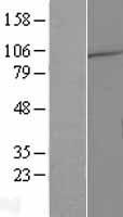 DNAI4 Human Over-expression Lysate