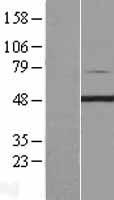 PIP4K2C Human Over-expression Lysate