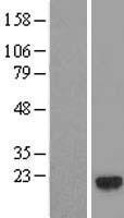 Gemin 6 (GEMIN6) Human Over-expression Lysate