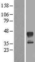 MRM1 Human Over-expression Lysate