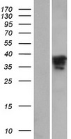 MAGIX Human Over-expression Lysate