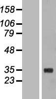 FBXO17 Human Over-expression Lysate