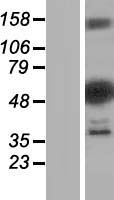 DENND2D Human Over-expression Lysate