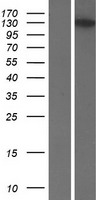 VCIP 135 (VCPIP1) Human Over-expression Lysate