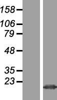 MZT2B Human Over-expression Lysate