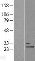 THOC7 Human Over-expression Lysate