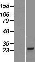 COQ10B Human Over-expression Lysate