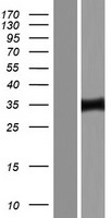 ZNF167 (ZKSCAN7) Human Over-expression Lysate