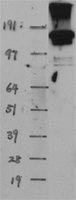 EHMT2/G9A (EHMT2) Human Over-expression Lysate