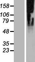 SLC35G2 Human Over-expression Lysate