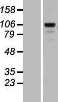 Matrilin 2 (MATN2) Human Over-expression Lysate
