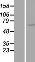 EEPD1 Human Over-expression Lysate