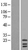 LIM2 Human Over-expression Lysate