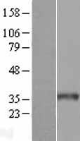 WDR61 Human Over-expression Lysate