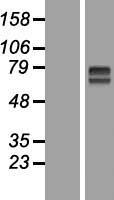 FCRL2 Human Over-expression Lysate
